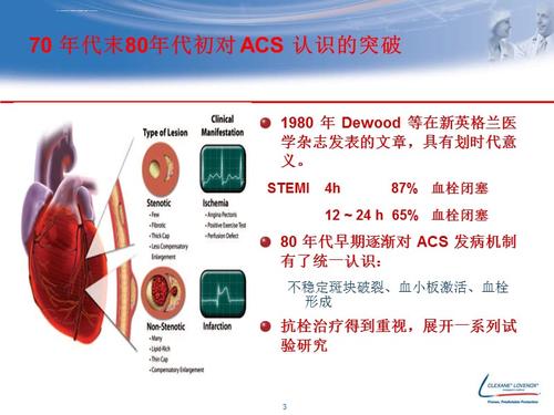 acs-acs醫(yī)學(xué)上是什么意思